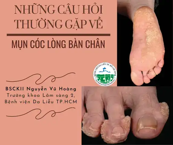 những câu nói về mụn