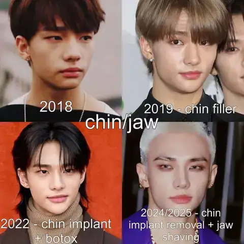 những câu nói hay về phẫu thuật thẩm mỹ